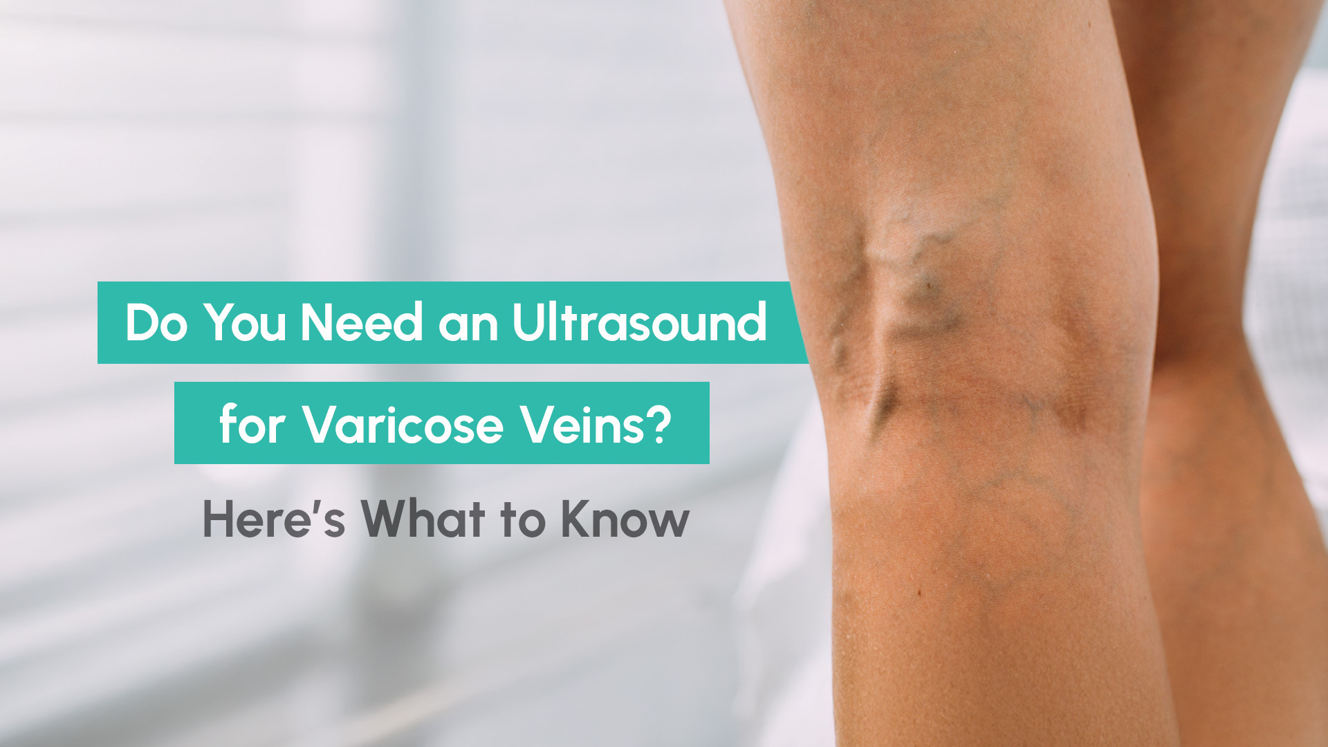 varicose vein ultrasound