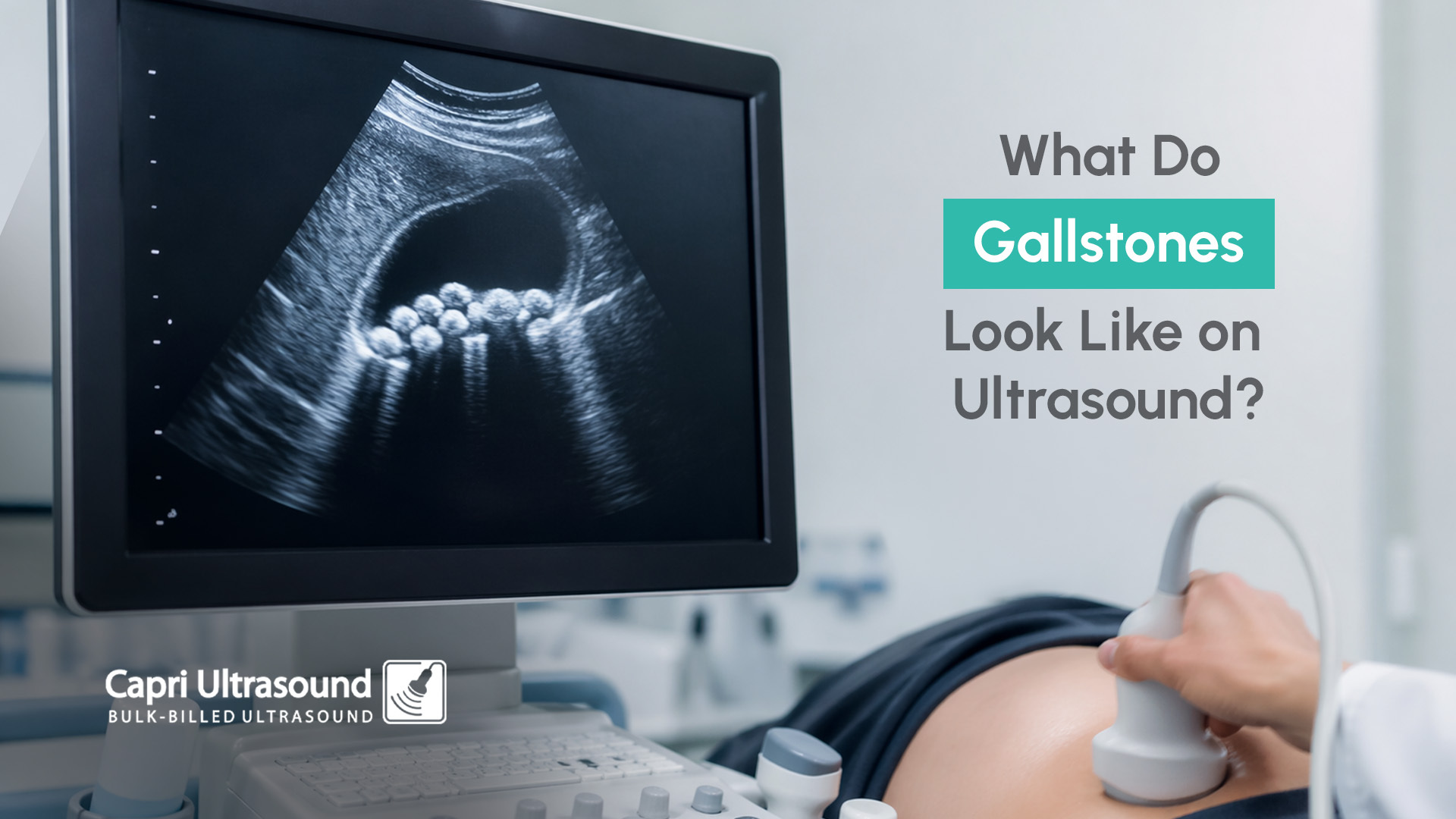 gallstones ultrasound