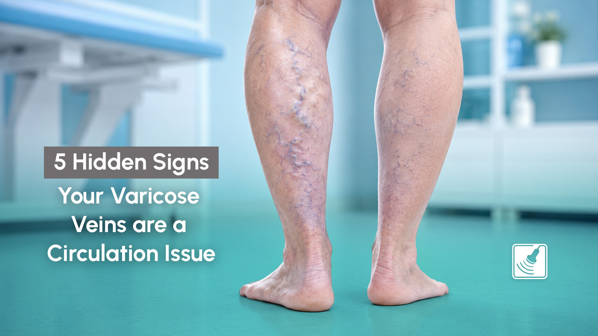 Varicose Veins are a Circulation Issue