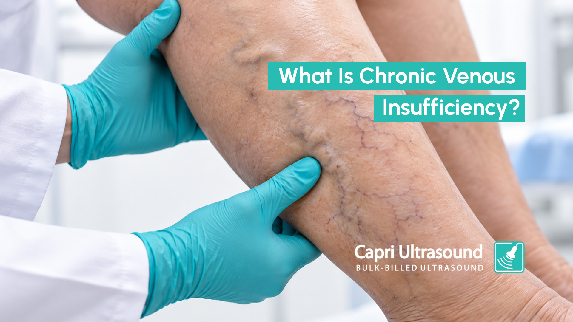 what is chronic venous insufficiency