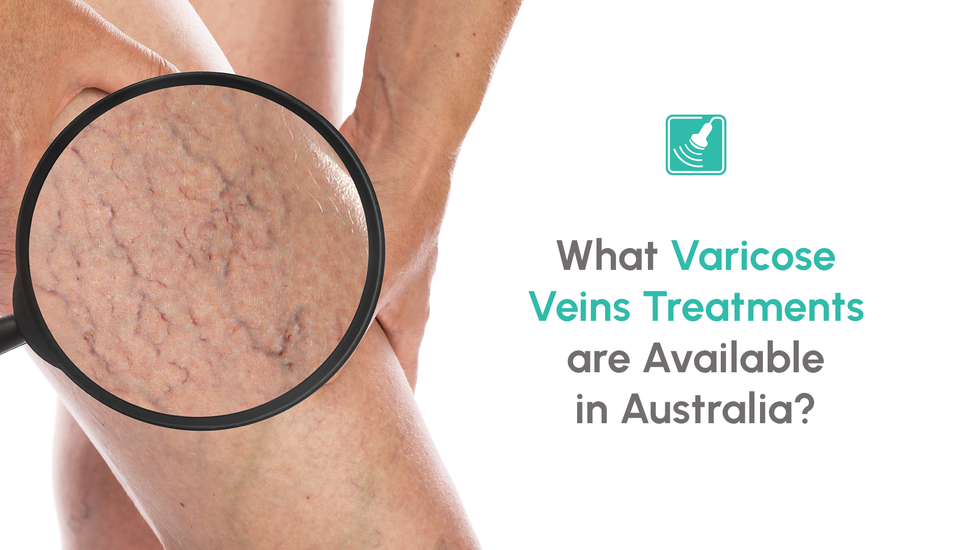 varicose veins treatments Capri Ultrasound